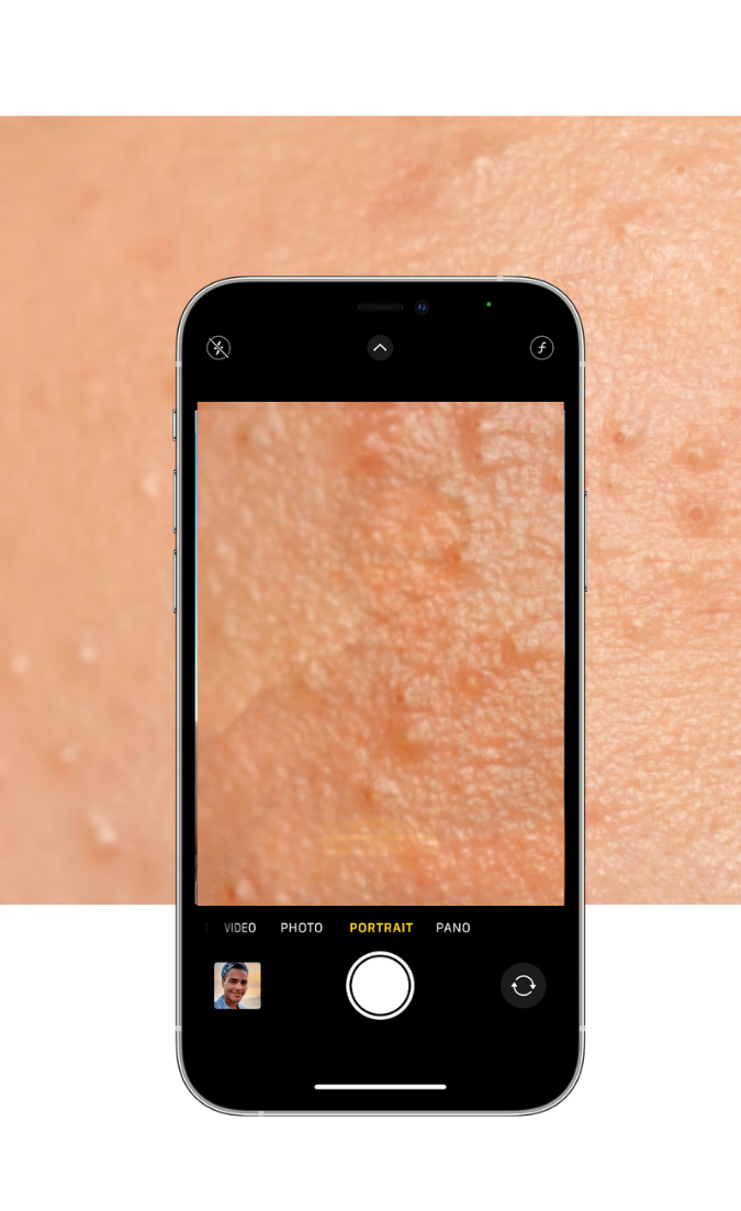 How DermResponse works